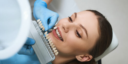 Things to know before opting for dental veneers