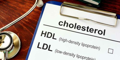 Tips to Lower Cholesterol Levels Naturally