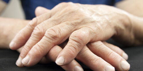 Treatment options and medications for managing rheumatoid arthritis