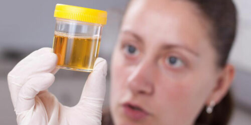 Types of urine colors and what they indicate