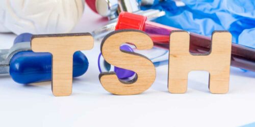 Understanding TSH Levels &#8211; How to Keep Them under Normal Range