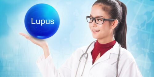 3 effective ways for living with lupus