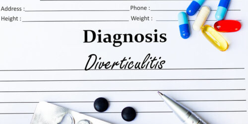 11 Foods that Trigger Diverticulitis