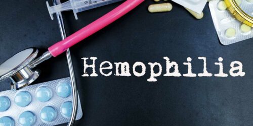 7 Common Ways to Treat Hemophilia