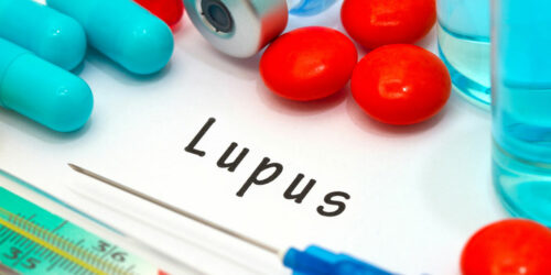 7 common symptoms of lupus