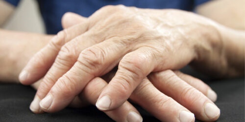 7 tips for living better with rheumatoid arthritis