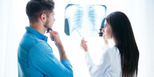 4 Frequently Asked Questions About Emphysema