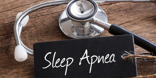 4 ways to manage sleep apnea