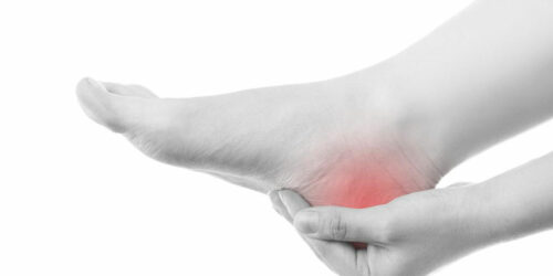 5 Natural Remedies for Treating Gout Pain