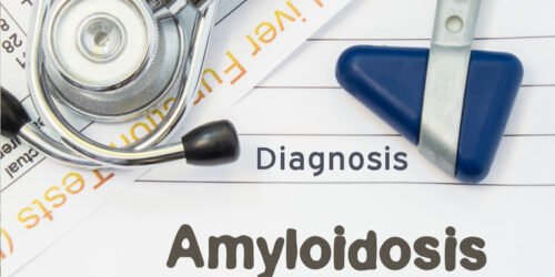 5 natural treatment options for amyloidosis