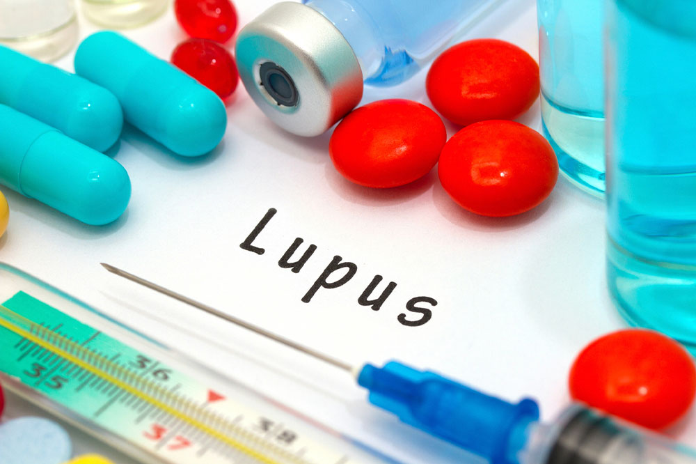 5 things to avoid with lupus