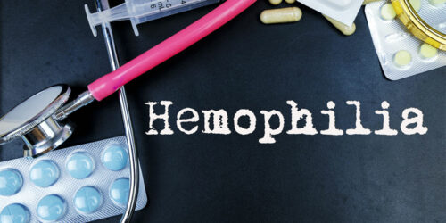 5 tips to manage hemophilia