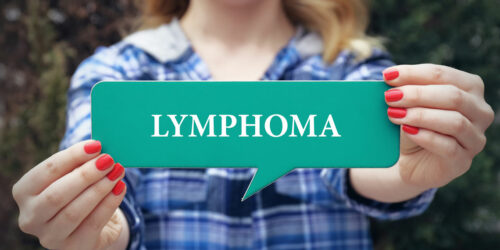 6 Factors That Contribute to the Risk of Developing Lymphoma