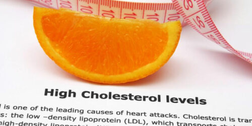 6 Self-Management Tips for High Cholesterol Treatment