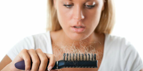 8 Common Causes of Hair Loss in Women and Their Treatments