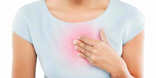 8 Effective Home Remedies for Heartburn