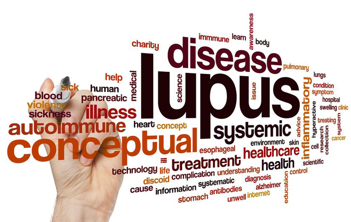 Common Symptoms of Lupus in Women