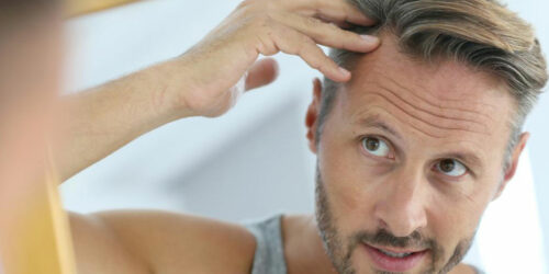 Causes and remedies of hair loss