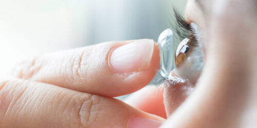 A Brief Overview Of Contact Lenses