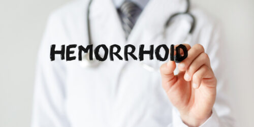 An Overview Of External Hemorrhoids- Causes, Symptoms, And Treatment