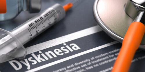 An overview of the symptoms and causes of dyskinesia