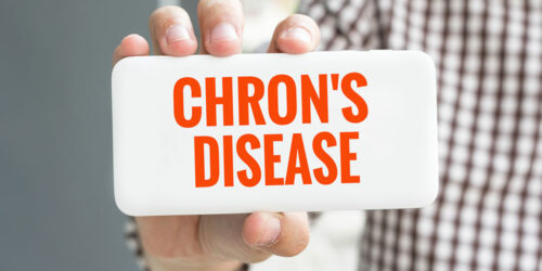 All You Need to Know about Chron&#8217;s disease