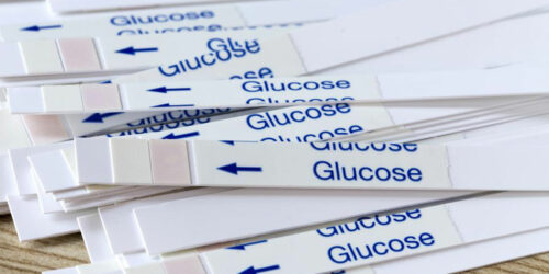 All You Need to Know about Blood Glucose Test