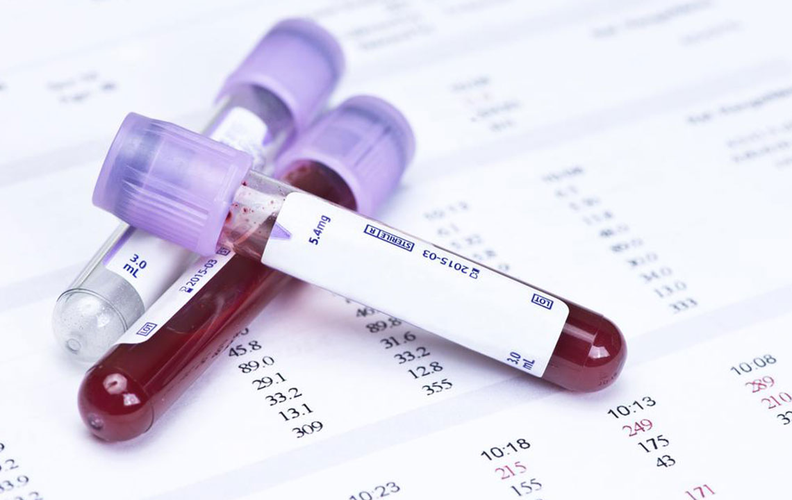 All You Need to Know about Glucose Levels Charts