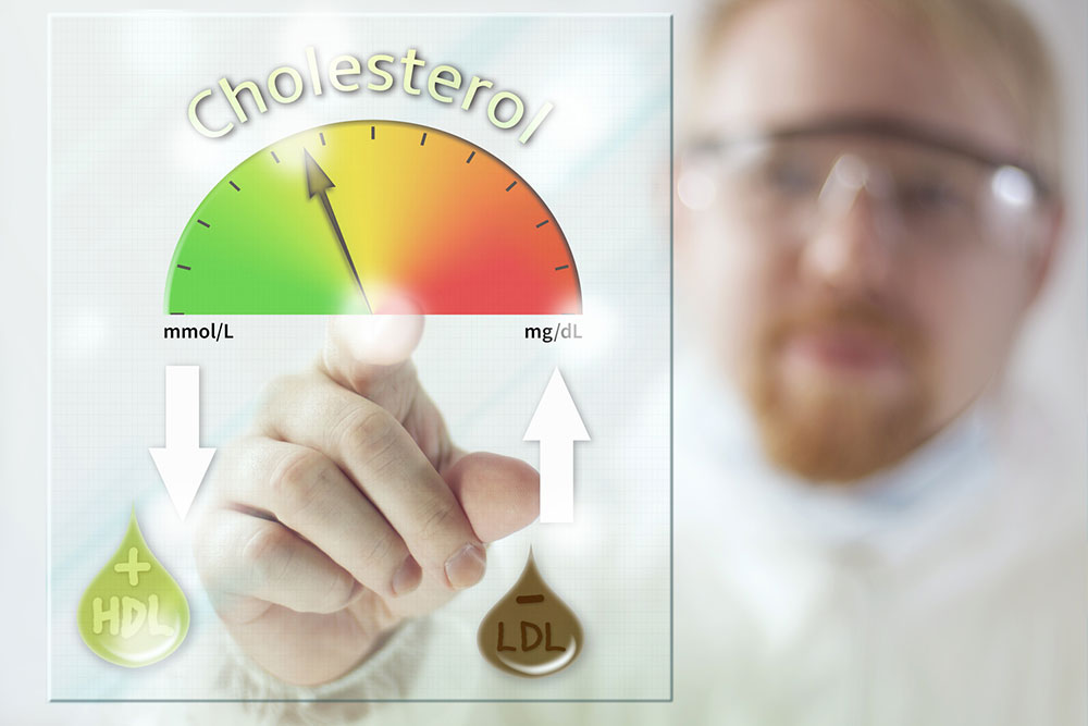 All You Need to Know about High Cholesterol Levels