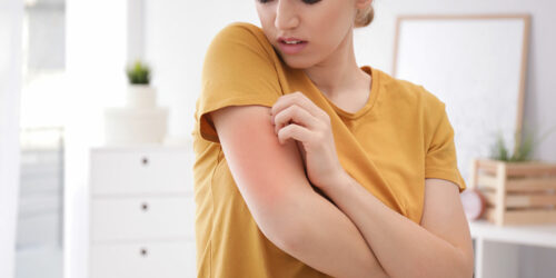 Allergies – Stages and prevention