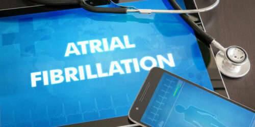 Atrial Fibrillation Treatment Options That Can Save Your Heart and Life