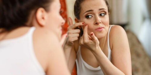 Basics of Adult Acne Treatment That You Need To Know