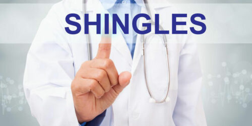 Best Treatment For Shingles Using Shingle Relief Creams