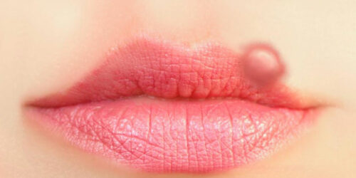 Get Quick Relief from Cold Sores