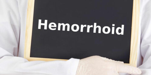 Get Relief with These Effective Hemorrhoids Treatment Options