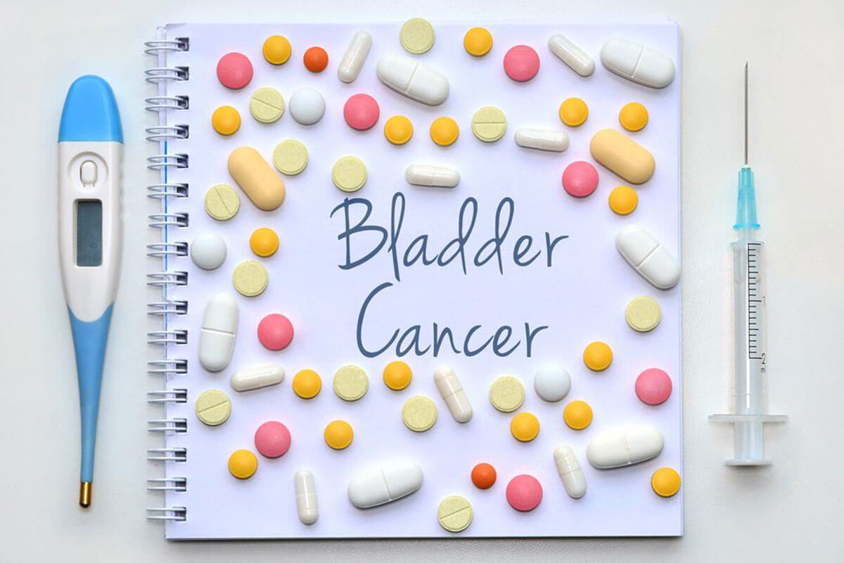 Do You Have Any of These Bladder Cancer Symptoms?