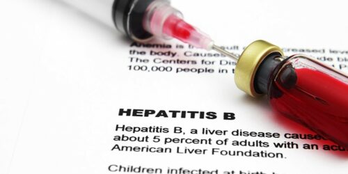 Do You Have These Hepatitis B Symptoms