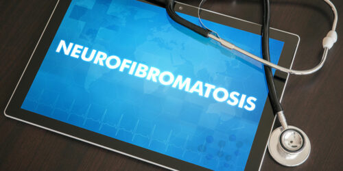 Doctor-recommended treatments for neurofibromatosis