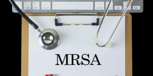 Different Ways to Treat MRSA