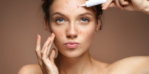 Different Types Of Skin Infections And Their Effective Treatments