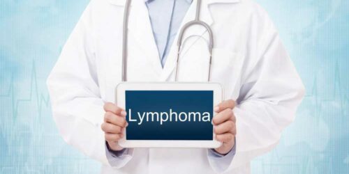 Different Types of Lymphoma You Should Know about