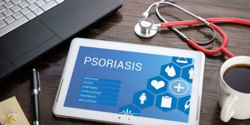 Easy DIY Remedies to Treat Psoriasis Symptoms