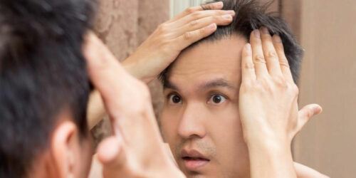 Effective Hair Loss Treatments for Thinning Hair