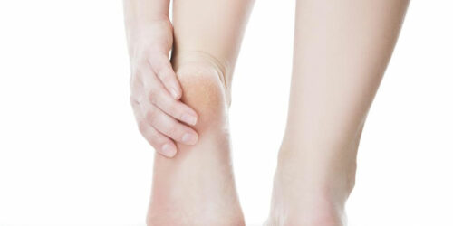 Effective Ways to Treat Diabetic Feet Problems