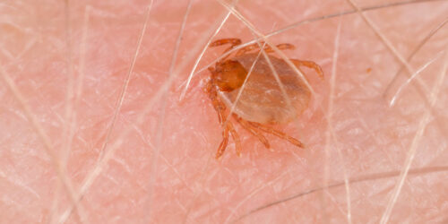 Effective Treatment Methods for Tick-borne Illness