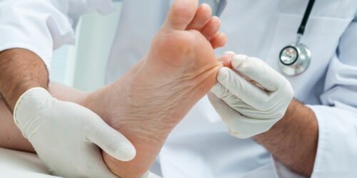 Effective Treatments for Toenail Fungus