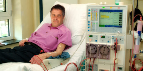 Essential Things to Know about Kidney Dialysis