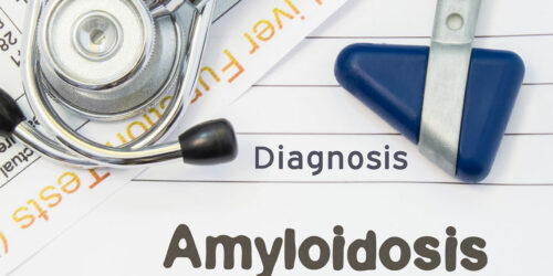 Everything About the Different Types of Amyloidosis