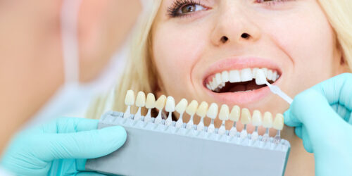 Everything You Need To Know About Dental Implants