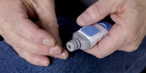 Everything You Should Know about a Blood Glucose Test